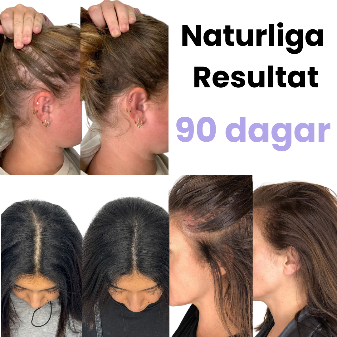 TheraBrush™ - 4-i-1 Terapiborste För Hälsosamt Hår