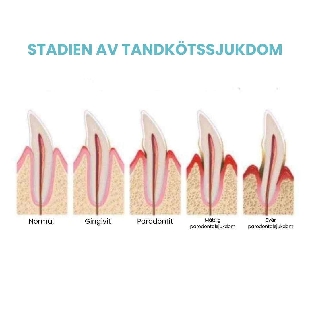 Brightify™ - Tandblekningsmousse för Vitare Tänder