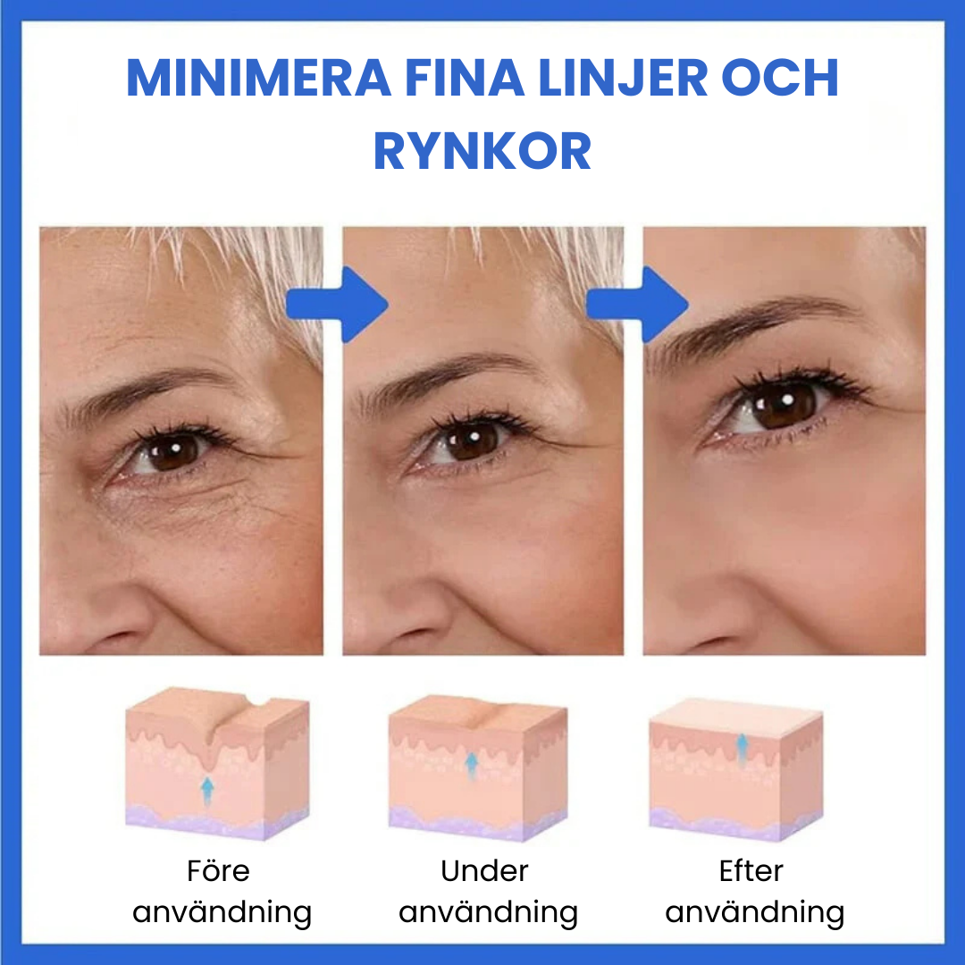 SkinLift™ - Botox Ansiktsserum Suddar Ut Linjer och Rynkor På Kort Tid