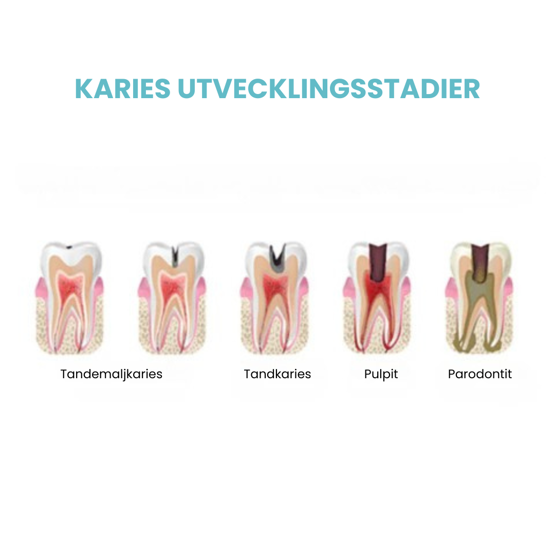 Brightify™ - Tandblekningsmousse för Vitare Tänder