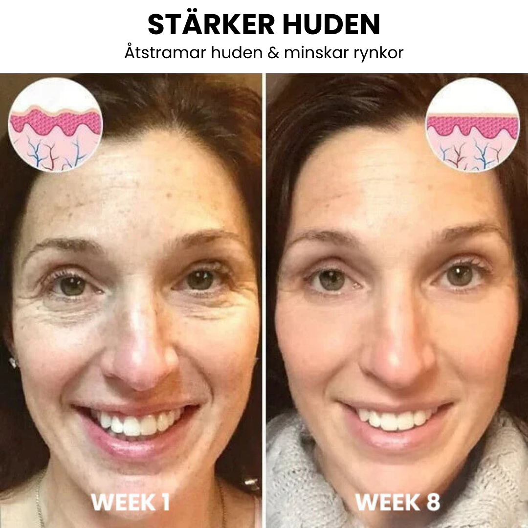 SkinLift™ - Botox Ansiktsserum Suddar Ut Linjer och Rynkor På Kort Tid
