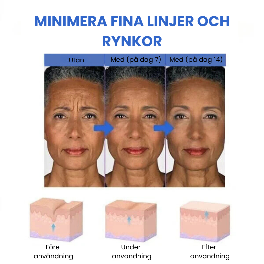 SkinLift™ - Botox Ansiktsserum Suddar Ut Linjer och Rynkor På Kort Tid