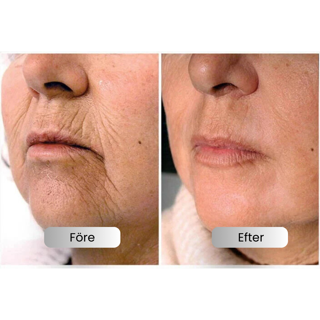SkinLift™ - Botox Ansiktsserum Suddar Ut Linjer och Rynkor På Kort Tid