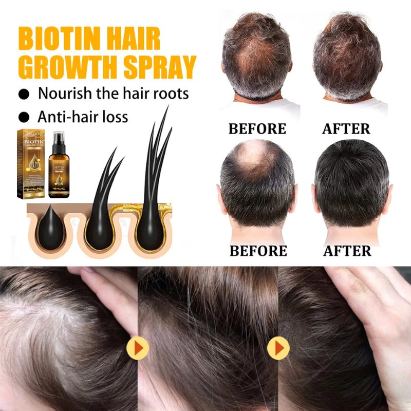 BioThrive™ - Biotin Premium Hårväxtserum