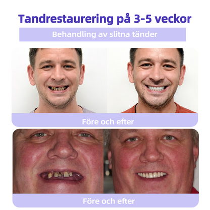 DentaPure™ - Mineral Restaurerande Tandpulver - Rekommenderad av Svenska Tandläkarförbundet