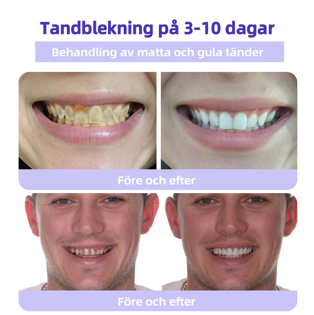 DentaPure™ - Mineral Restaurerande Tandpulver - Rekommenderad av Svenska Tandläkarförbundet