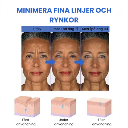 SkinLift™ - Botox Ansiktsserum Suddar Ut Linjer och Rynkor På Kort Tid