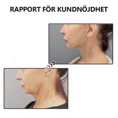 Lunaris™ - Lindra Svullnader med Magnetterapi-Halsband.
