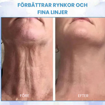 Firmora™ - Huduppstramande Essence-kräm För Åtstramning Och Utslätning