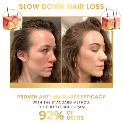 BioThrive™ - Biotin Premium Hårväxtserum