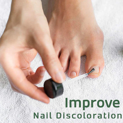 Nailuxe™ - Nagelskydd Med Bigiftbehandlingsserum För Starkare Och Hälsosammare Naglar
