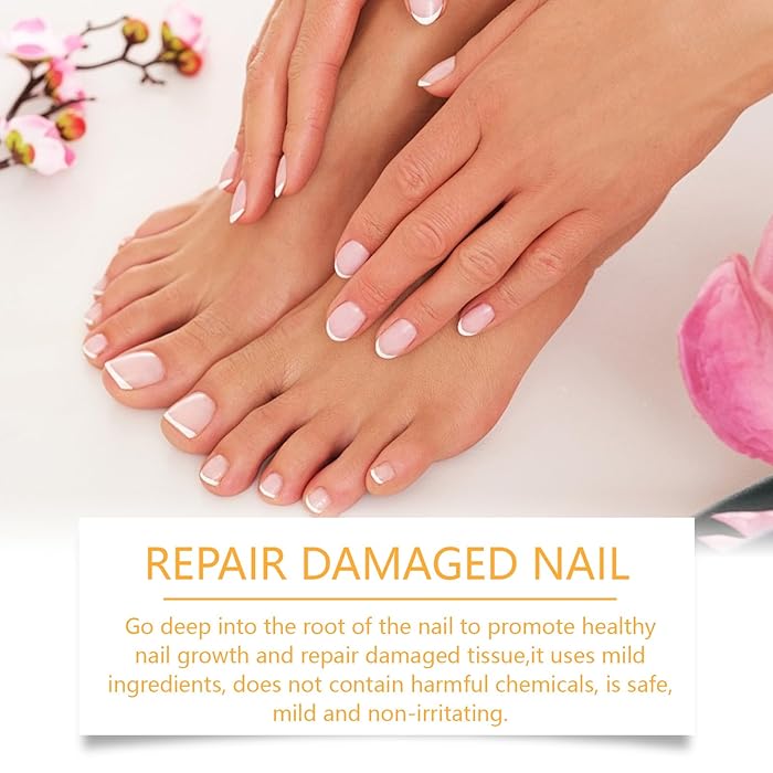 Nailuxe™ - Nagelskydd Med Bigiftbehandlingsserum För Starkare Och Hälsosammare Naglar